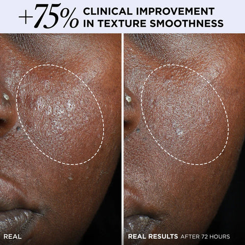 Confidence in a Cream® Barrier Boost Skin Barrier Repair Daily Moisturizer