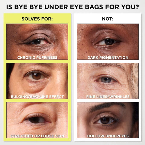 Bye Bye Under Eye Bags Daytime Treatment